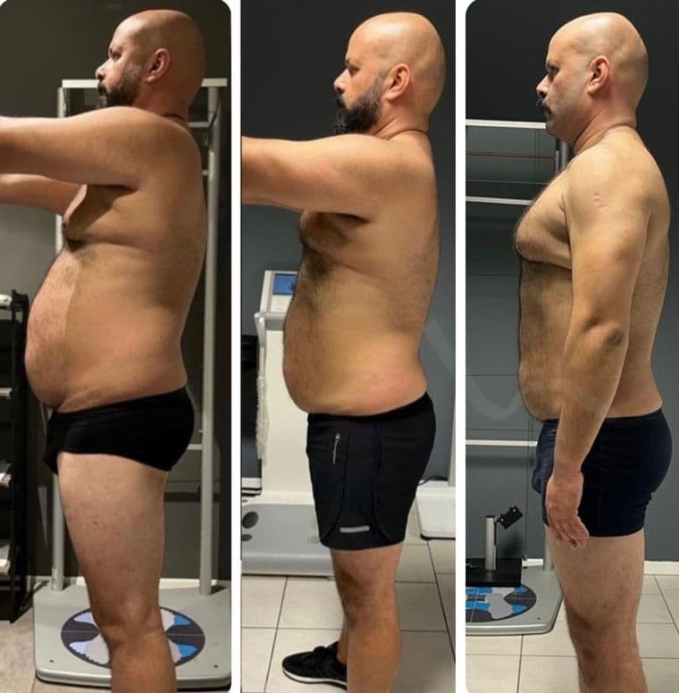 Risultato di un cliente di Adrian – prima e dopo
