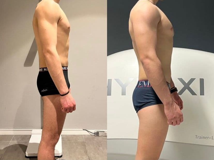 Risultato di un cliente di Adrian – prima e dopo
