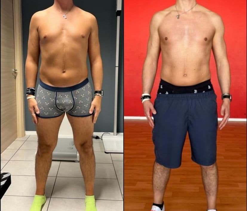Risultato di un cliente di Adrian – prima e dopo