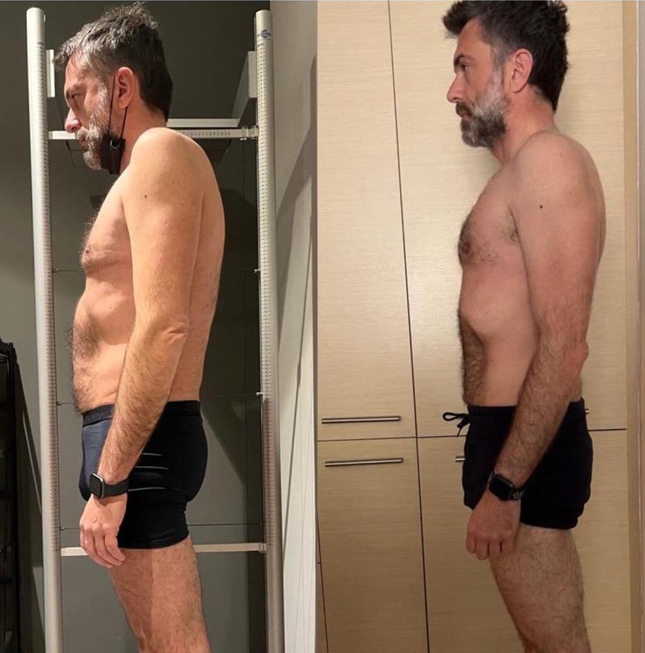 Risultato di un cliente di Adrian – prima e dopo