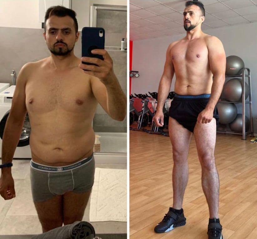 Risultato di un cliente di Adrian – prima e dopo